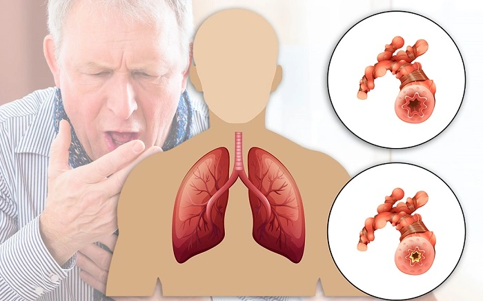 بهترین دکتر ریه و آلرژی در اصفهان