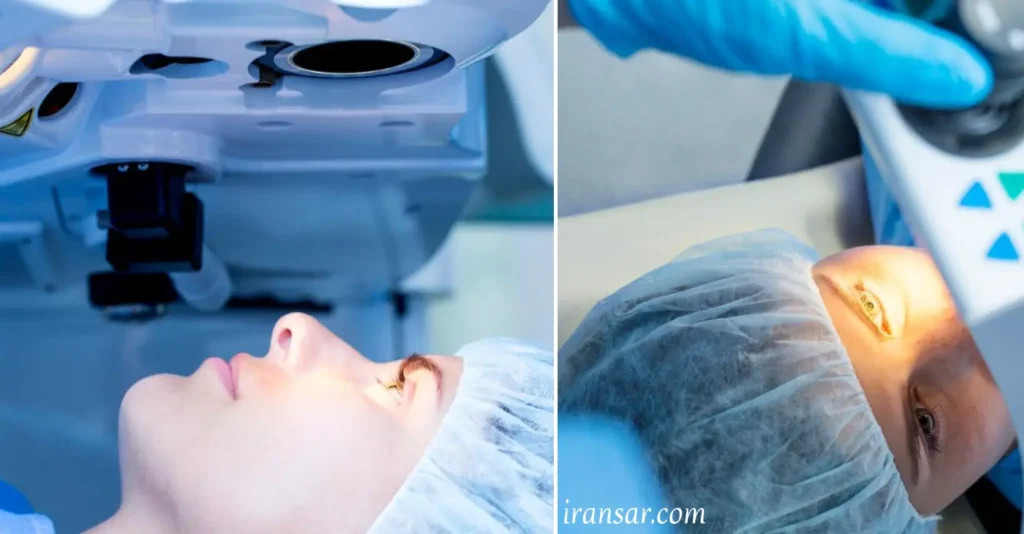 بهترین دکتر لیزیک چشم در اهواز