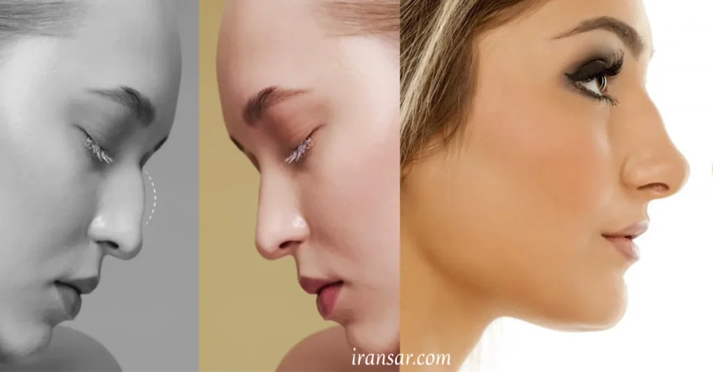 بهترین جراح بینی اهواز