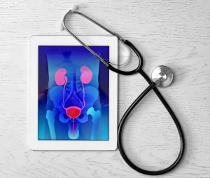 بهترین اورولوژیست تهران